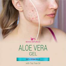 Gel de Aloe Vera - Hecho con 100% Aloe Orgánico Infundido con EGF, Células Madre, Aceite de Romero - Hidratante Natural para Rostro, Body y Cabello. Para Quemaduras de Sol, Acné y Granitos. 16.9 Fl Oz - Aceite de romero + EGF - Ver 7