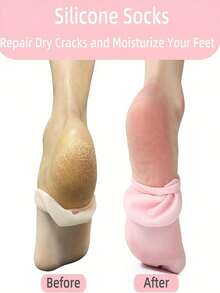 2 件/4 件硅胶保湿袜，隔夜 SPA 足部护理，防滑凝胶脚跟，高弹性，家用干足修复，可重复使用