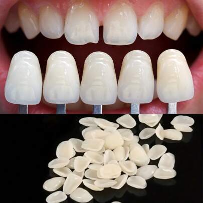 50 tiras de clareamento dental, simples e convenientes, adequadas para todos os formatos de dentes, aumentam a confiança e o apelo do sorriso