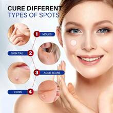 144pcs Face Care Patches, Hydrocolloid Material For Blemish Coverage, Contains Safe Botanical Ingredients, Gentle & Non-Irritating, Alcohol-Free, Relaxes Mind And Relieves Fatigue