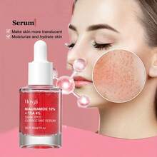Hoygi Facial Care Serum - Moisturizing Formula To Help Minimize Pores And Improve Skin Texture, Gently Reduces The Appearance Of Dark Spots And Promotes A Brighter, Smoother Complexion - 粉色 - 查看 4