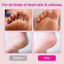 60Pcs/Box Foot Sandpaper,Flexible Callus Remover Pads For Electric Pedicure Tools, Multi-Grit Grinding Files For Dead Skin,Salon & Home Pedicure Essential,Great For Travel & Gym Use