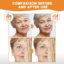 Conopeptide Deer Bone Collagen Essence Set Lightens Fine Lines, Prevents Aging, Moisturizes And Firms Facial Skin,Instant Skin Essence Collagen Set,Spiral Peptide Deer Bone Collagen Essence Kit,Lasting Moisturizing And Firming For Reduce Fine Lines & Wrinkles - Multicolor - View 7