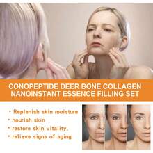 Conopeptide Deer Bone Collagen Essence Set Lightens Fine Lines, Prevents Aging, Moisturizes And Firms Facial Skin,Instant Skin Essence Collagen Set,Spiral Peptide Deer Bone Collagen Essence Kit,Lasting Moisturizing And Firming For Reduce Fine Lines & Wrinkles - Multicolor - View 6