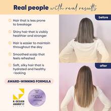 Moerie Volumizing Shampoo And Conditioner Hair Loss - Thickening Products With Ingredients Of Natural Origin - Over Active Ingredients Thick, Long, Luscious Hair, 2 X 8.45 Fl Oz - Double Set - View 1