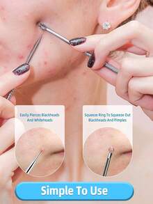 2 件不锈钢黑头去除器、粉刺提取器、粉刺挤破器、粉刺提取器、手术级痤疮治疗工具、面部、鼻部、T 区瑕疵去除套装、黑头去除器、美容、护肤产品、水疗、自我护理、护肤工具、面部护理、美容师用品、皮肤、洗面奶、面部 - 銀色 - 查看 3