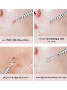 2 件不锈钢黑头去除器、粉刺提取器、粉刺挤破器、粉刺提取器、手术级痤疮治疗工具、面部、鼻部、T 区瑕疵去除套装、黑头去除器、美容、护肤产品、水疗、自我护理、护肤工具、面部护理、美容师用品、皮肤、洗面奶、面部 - 銀色 - 查看 9