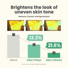 1.69oz Niacinamide Serum Gel, Suitable For Daily Use - Multicolor - View 4