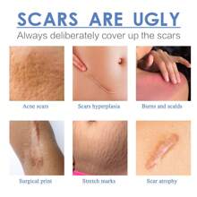 4 Pcs X 150cm Silicone Scar Sheets, Cover Surgery Scars, Waterproof Breathable Skin Scar Beauty Concealer Tape