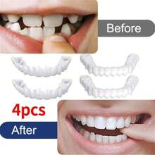 4Pcs Comfort-Flex White Cosmetic Teeth Cover, Perfect Smile Enhancing Veneers Upper & Lower Teeth For Daily Wear