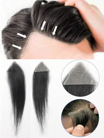 Parche frontal, postizo, patillas, tupé invisible, sin costuras, ultra delgado, PU, parche para la línea del cabello, patillas, cicatriz, peluca para la parte superior de la cabeza, alopecia areata, cicatriz de quemadura, parche pequeño para peluca, para hombres y mujeres, parche biológico para cicatriz del cabelludo