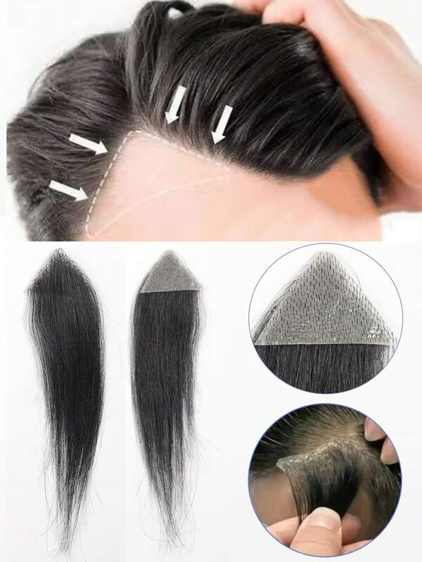 Aplique de testa, costeletas, peruca, invisível, sem costura, ultrafina, pele de PU, linha capilar masculina, costeletas, cicatriz, remendo de cabelo, topo da cabeça, alopecia areata, cicatriz de queimadura, pequena área, peruca, remendo biológico para homens e mulheres, couro cabeludo, cicatriz