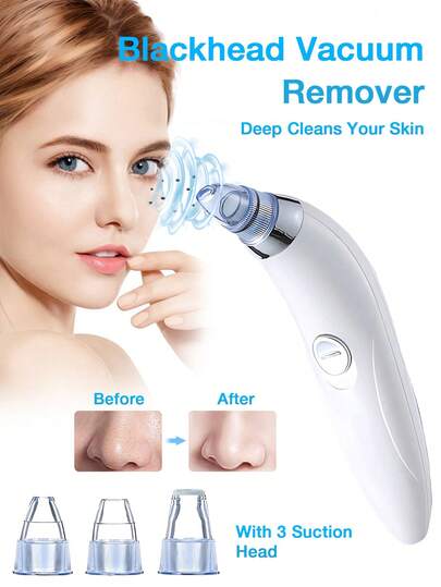 GENAI 黑头真空吸出器，强力便携式面部毛孔清洁器，配备4个吸头，温和去除黑头，男女通用，无需挤压，告别疼痛。您的专属专业美容师，电池供电（不含电池）。