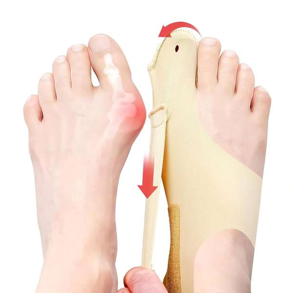 2 Pcs  & Adjustable Toe Spacer Women & Men-Big Toe Support With Side & Heel Straps, Hallux Valgus Pain Relief, Comfortable Day & Night.(1, Beige, Medium)