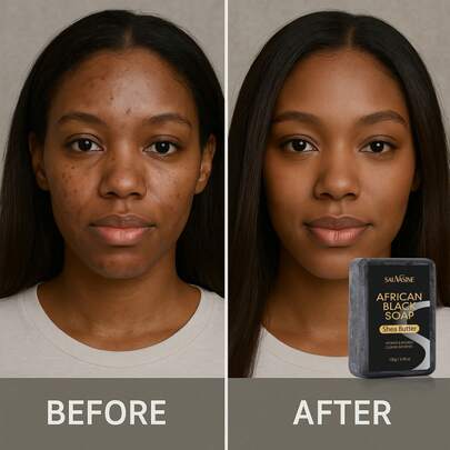 传统非洲黑皂，蕴含乳木果油、可可豆荚和棕榈仁油。深层清洁，去除污垢、彩妆残留和多余死皮，疏通毛孔，控油，调节皮脂分泌，令肌肤焕然一新。具有抗炎抗菌功效，有助于改善痤疮、粉刺、湿疹，舒缓肌肤，淡化斑点，均匀肤色。适合所有肤质，适合日常使用。