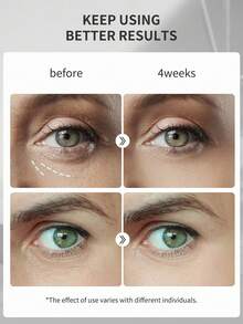 The Ordinary 多肽眼部精华，抗衰老配方，针对鱼尾纹、黑眼圈和浮肿，保湿，0.5 液体盎司/15 毫升 - 15mL - 查看 3