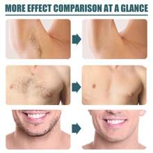 Fumorry 120g Men's Hair Removal Cream - Gentle, Non-Irritating, Rapid Action On Face, Legs, Armpits, Arms, No Trace Or Blackhead Left