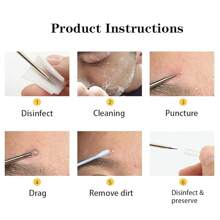 Kit de eliminación de puntos negros y granos 4 piezas con extractor de espinillas, acné y comedones en nariz y rostro, conjunto de eliminación de puntos blancos de acero inoxidable