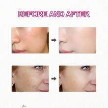 7%熊果提取物+4%氨甲环酸乳膏，含70,000ppm熊果提取物、40,000ppm氨甲环酸、烟酰胺、谷胱甘肽，适用于淡化色斑、雀斑、瑕疵和色素沉着，50毫升 - 無色 - 查看 7