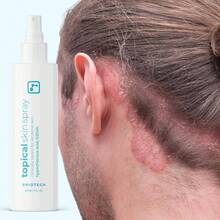 Spray de piel tópico BRIOTECH, spray de ácido hipocloroso para el Body y el rostro, limpiador de párpados, bruma facial de HOCl, apoyo contra la irritación y el enrojecimiento, el empaque puede variar, 4oz (1 pieza) - 2 onzas líquidas (paquete de 1) - Ver 8