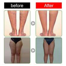 Cleaning Foot Patch (10pcs) Deep Cleaning Body Foot Care Moisture Repair Foot Patch - 10 cái - Xem 3