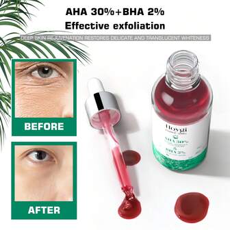 30ml Face Acid Essence, 2% Salicylic Acid Essence, Pore Minimization Moisturizing Formula, Suitable For All Skin Types, No Irritation, No Alcohol