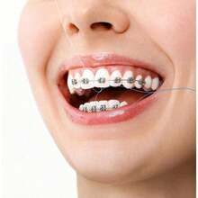 1盒牙线方便在牙齿矫正期间清洁牙齿缝隙 - 彩色 - 查看 6