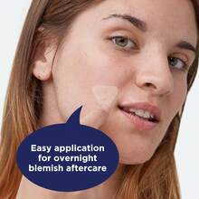 PanOxyl Blemish Brightening Patches: Dermatologist-Recommended, Help Fade Post-Acne Dark Spots And Reduce Redness, Large Clear Patches Cover A Bigger Area, Vegan And Latex-Free, 16ct - White - View 5