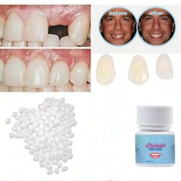 Kit di perline per denti fai-da-te - Palline termoplastiche riutilizzabili per decorazioni dentali temporanee, cosplay e zanne da vampiro