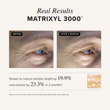 Asterwood Triple Repair Matrixyl 3000 + Argireline + Hyaluronic Acid + Vitamin C Serum For Face - Anti-Aging, Collagen Boosting, Hydrating - Fragrance-Free - 1 Fl Oz - 4 Fl Oz (Pack Of 1) - View 5