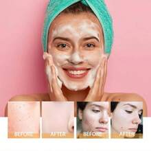 2 Pics / Pack NEW - Veecent Turmeric + Kojic Acid Foaming Facial Cleanser + Silicone Brush Cleansing Skincare Comfort Skin Repair - 150ml*1 - View 3