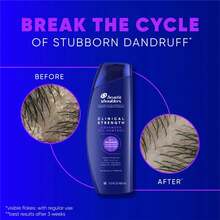 Clinical Strength Anti-Dandruff Citrus Shampoo For Advanced Oil Control - 13.5 Fl Oz