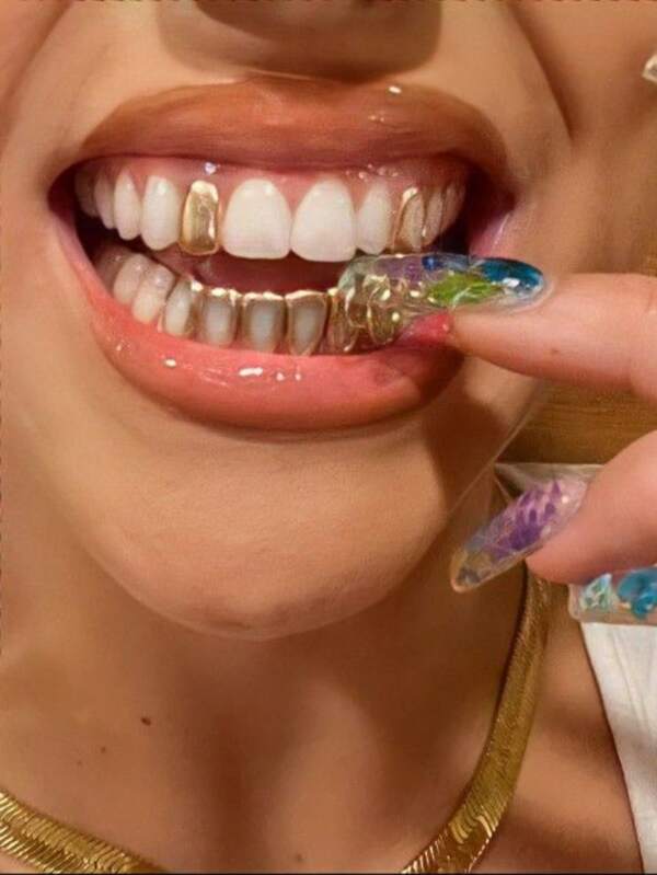 1 Set Glossy Hollow Top & Fully Hollow Bottom Combo Hip Hop Tooth Jewelry For Party, Nightclub Decorations, Unisex Gifts With Detachable Tooth Grips For Adjustment