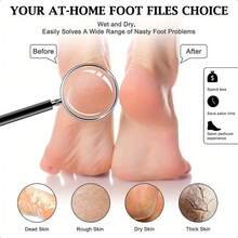 4 piezas Limas de pedicura de doble grano, de grueso y , raspadores de pies de doble cara, removedor de callosidades para pies suaves, cepillo para talones para el cuidado de los pies, raspa pies exfoliante, con mango de plástico - Multicolor - Ver 4
