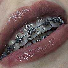 200 件/套时尚闪光随机款式水钻牙齿宝石贴纸，适合男女牙齿保持器或日常佩戴，无需胶水 - 彩色 - 查看 1