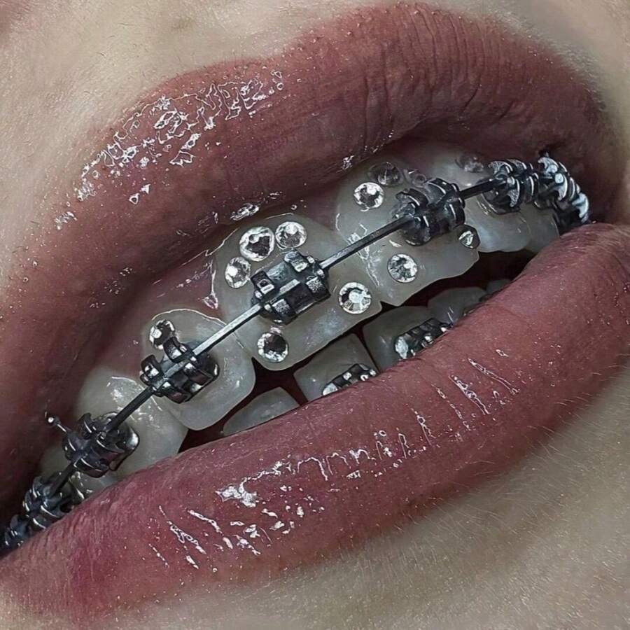 200 件/套时尚闪光随机款式水钻牙齿宝石贴纸，适合男女牙齿保持器或日常佩戴，无需胶水 - 彩色 - 查看 1