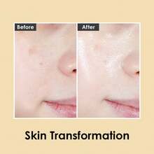 Organic Cactus Magic Serum, Anti-Wrinkle & Brightening, Rejuvenation, Strengthen Skin Barrier, Probiotics, Hydrating, Facial Ampoule, Pore Refining