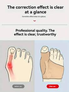 1 Pair Ribbed Knit Fabric For Sports, Home, And Office, Corrects Hallux Valgus And Big Toe Deviation - Black - View 5