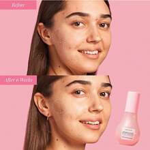 Glow Recipe Watermelon Niacinamide Dew DropS - Brightening, Plumping Hydrating Face Serum, Makeup Primer + Liquid Highlighter With Hyaluronic Acid - Dewy &Amp; Glowing Korean Skin Care (40ml) - Door Ornament - View 8