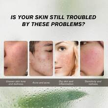 Sérum para Piel Sensible con Enrojecimiento: Ácido Azelaico 10%+ + Ácido Hialurónico (Antienflamatorio, Sin Resecamiento) - Azul Cadete - Ver 8