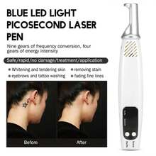 Handheld Picosecond Laser Pen Tattoo Scar Freckle Removal Machine Skin Beauty Device Skin  Tag  Laser  Removal - 1 - View 2