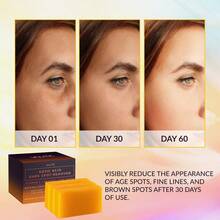 3pcs Kojic Acid Dark Spot Remover Soap Bars With Vitamin C, Retinol, Collagen, Turmeric - Original Japanese Complex Infused With Hyaluronic Acid, Vitamin E, Shea Butter, Castile Olive Oil - 黃色 - 查看 2