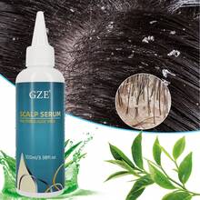GZE Scalp Serum With Tea Tree & Aloe Vera Leave-In Conditioner Remove Loose Dandruff Flakes​ For Dry Scalp For Women And Men Detangles Hair - 藏蓝色 - 查看 5