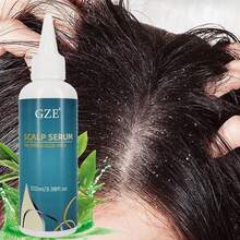 GZE Scalp Serum With Tea Tree & Aloe Vera Leave-In Conditioner Remove Loose Dandruff Flakes​ For Dry Scalp For Women And Men Detangles Hair - 藏蓝色 - 查看 3