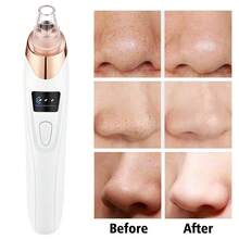 Upgraded Blackhead Remover Tool, 3 Adjustable Suction Levels, 5 Replacement Heads, USB Rechargeable Facial Pore Cleaner, Unisex - White - View 8