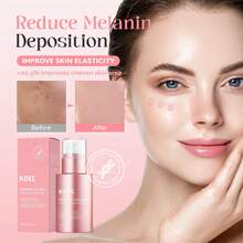 KOEC PDRN Pink Collagen Exosome 2000 Serum,Liquid Skin Booster Serum For Hydrating,Uneven Skin Tone, Pore Care, Skin Texture,Korean Skin Care - Pink - View 3