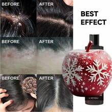 Shampoo,  Ringworm Anti-Itch Shampoo Anti-Hair Loss Refreshing Oil Control Hair Care Anti-Dandruff Anti-Itch Shampoo - 1 - View 3