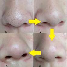15/50Pcs Deep Cleansing Nose Stickers, Nose Spot Facial Stickers, Nose Mask, Nose Mask For Cleaning Acne Blackheads