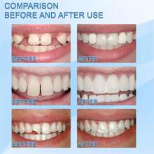 Conjunto de 1 peça de dentes postiços de terror "faça você mesmo" (apenas para fantasia) para brincadeiras de faz de conta em festas. Pastilhas moldáveis para dentes postiços, contas adesivas para preenchimento de espaços, decoração de dentes reutilizável e personalizável para o Halloween.