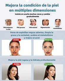 KINGSTEAM Facial Hydration Appliances - 白色 - 查看 8